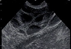 生中だしの結果…産婦人科で診て貰いました
