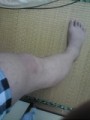脚・画像つきに注意