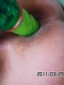 アナル拡張