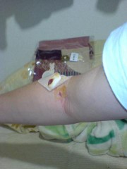 血を見てきました(^^;