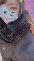 ものもらいになって人権がない