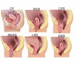 子宮って落ちるらしい…