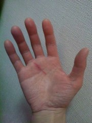 怪我をしました