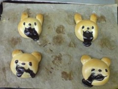 恐怖！エボラ出血熱発症後の写真