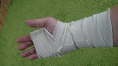 手術が済みました