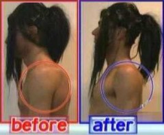 猫背の害について