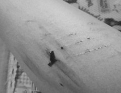 いてて(*p´д`q)゜。