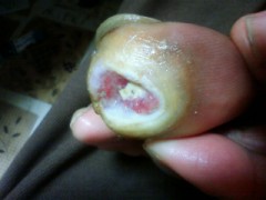 イテテ２・・・・(￣∇+￣)v