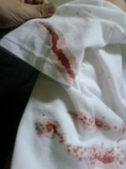 (￣Д￣;) ご飯時には見ないでね～♪