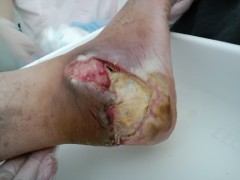 薬漬けの日々・・・(￣∇+￣)v