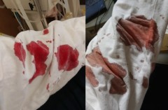 腕が～！腕が～！腕が～っ！・・・Σヽ(ﾟДﾟ○)ﾉ