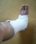 病院へ行きました。汚い足の画像つき。