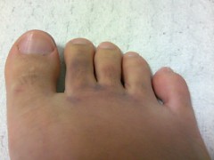 僕の右足チャン