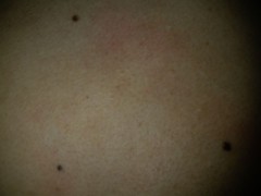 【お題日記】セクシーなホクロってどこ？