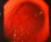 そういえば去年の今頃、体重が１５ｋｇも減りました。