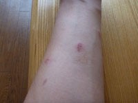 やっちゃっていまだ治らず