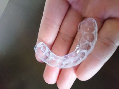 ナイトガード(マウスピース)したことありますか？