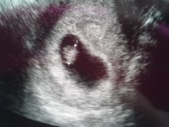 【お題日記】自分の恋人を素敵だと思っていますか？