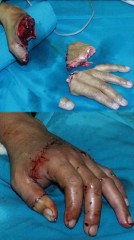 【 非 お題日記】別れた相手と・・・※グロ画像注意ｗ　画像は拾い物ってことでｗ