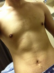 乳首