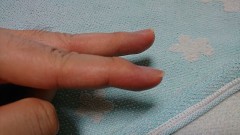 【お題日記】骨折した経験ありますか？