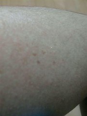 シ、シミが・・・