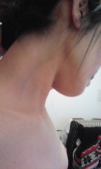 浮いた首筋の血管～(*^^*)