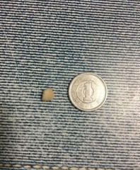 【お題日記】急に歯が抜けたことある？