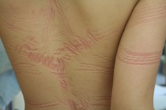 荒縄や強者どもが夢のあとｗ