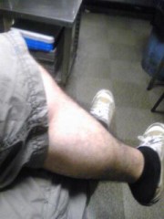 ぼくのふくらはぎをお食べよ！