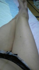 血管が透ける程の美白＾＾