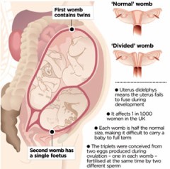 穴、２つ！？？