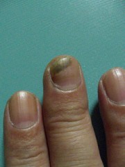 爪が急に黒く・・・(^-^;