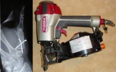 誤って自分のキンタマに釘打機を発射！