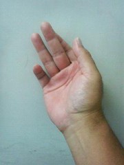 変態との境目は？