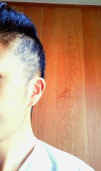 【お題日記】只今脱毛中です!!