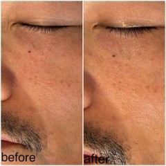 44歳になり老いに抗う為の投資をしはじめたよ