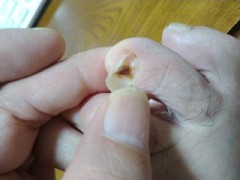 新年早々　閲覧注意　きもいぞ