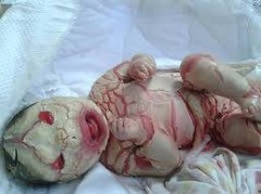 みよ、コレが放射能だ