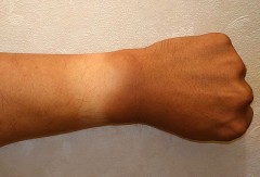 腕がこんな感じに