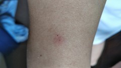 【お題日記】今となっては笑えるやっちゃったコト