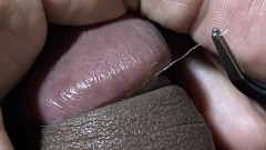 縫合糸を見ていたら