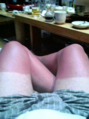 日焼けと運動会