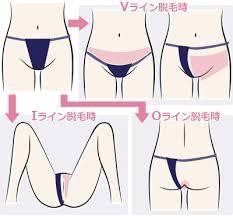 VIO脱毛で感じてしまう（濡れてしまう）のはヤバい？
