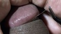 縫合糸を見ていたら