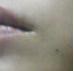 ほくろ2